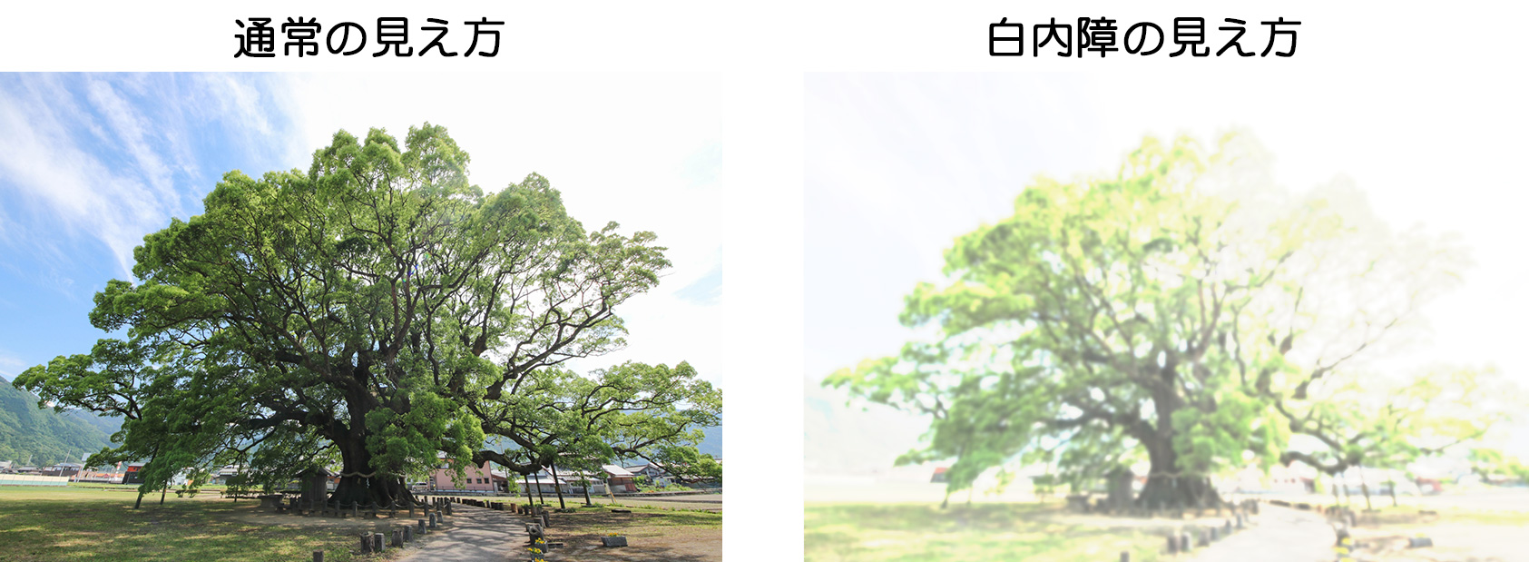 白内障の見え方